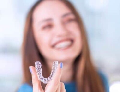 What You Should Know About Invisalign Teen