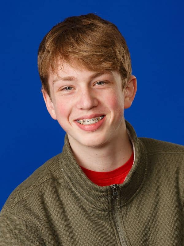 Braces-smiling-orthodontic-treatment (2) Patient smiling with braces on teeth