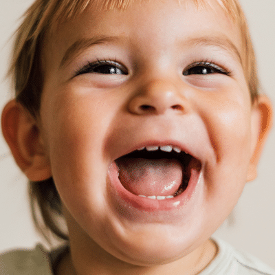 How primary teeth affect permanent teeth alignment 4 Smiling toddler showing healthy primary teeth that help demonstrate how primary teeth affect permanent teeth alignment during early childhood development