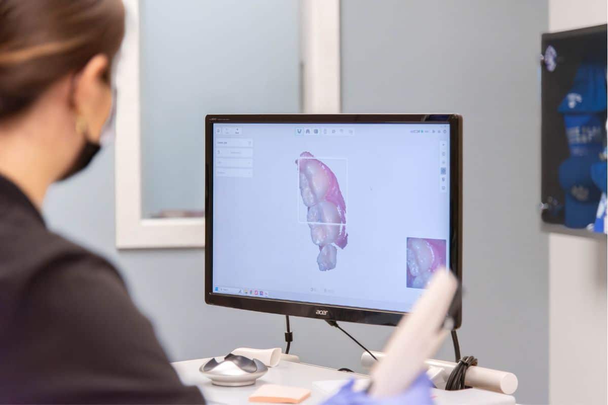 Expert-invisalign-treatment-scanner-monroe Invisalign®