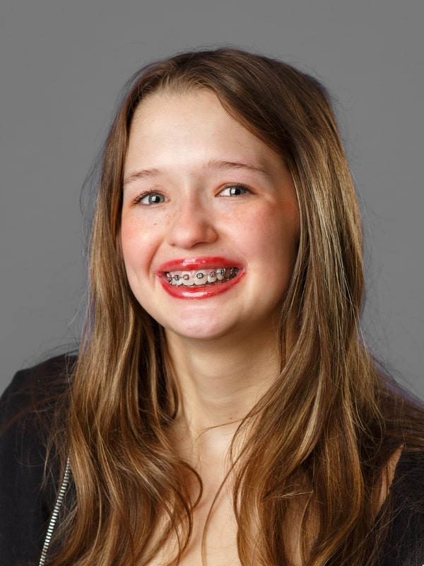 Jones-family-orthodontics-liberty Girl smiling with braces during orthodontic visit at jones family orthodontics