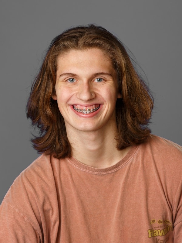Jones-family-orthodontics-owen Young man with shoulder-length hair smiling with braces at jones family orthodontics